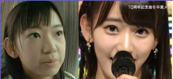 マジで整形やり過ぎてる!と思う芸能人は?