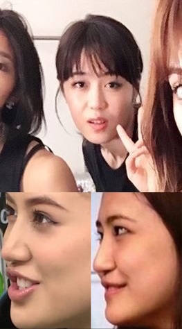 マジで整形やり過ぎてる!と思う芸能人は?