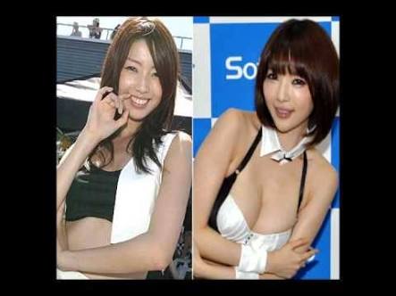 マジで整形やり過ぎてる！と思う芸能人は？