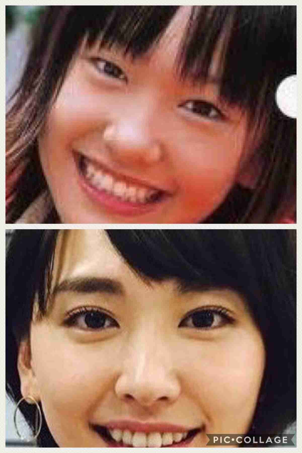 マジで整形やり過ぎてる！と思う芸能人は？