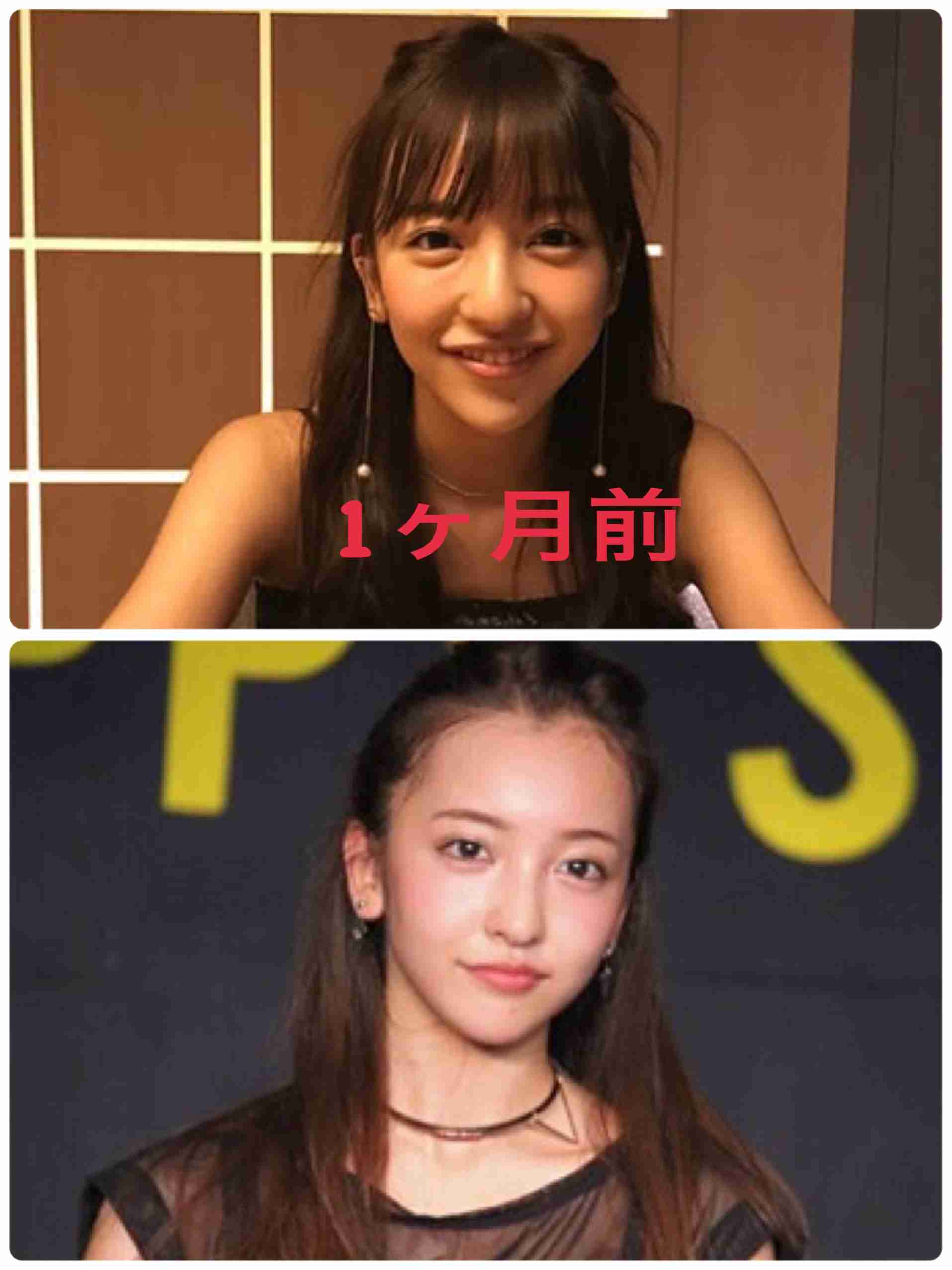 マジで整形やり過ぎてる!と思う芸能人は?