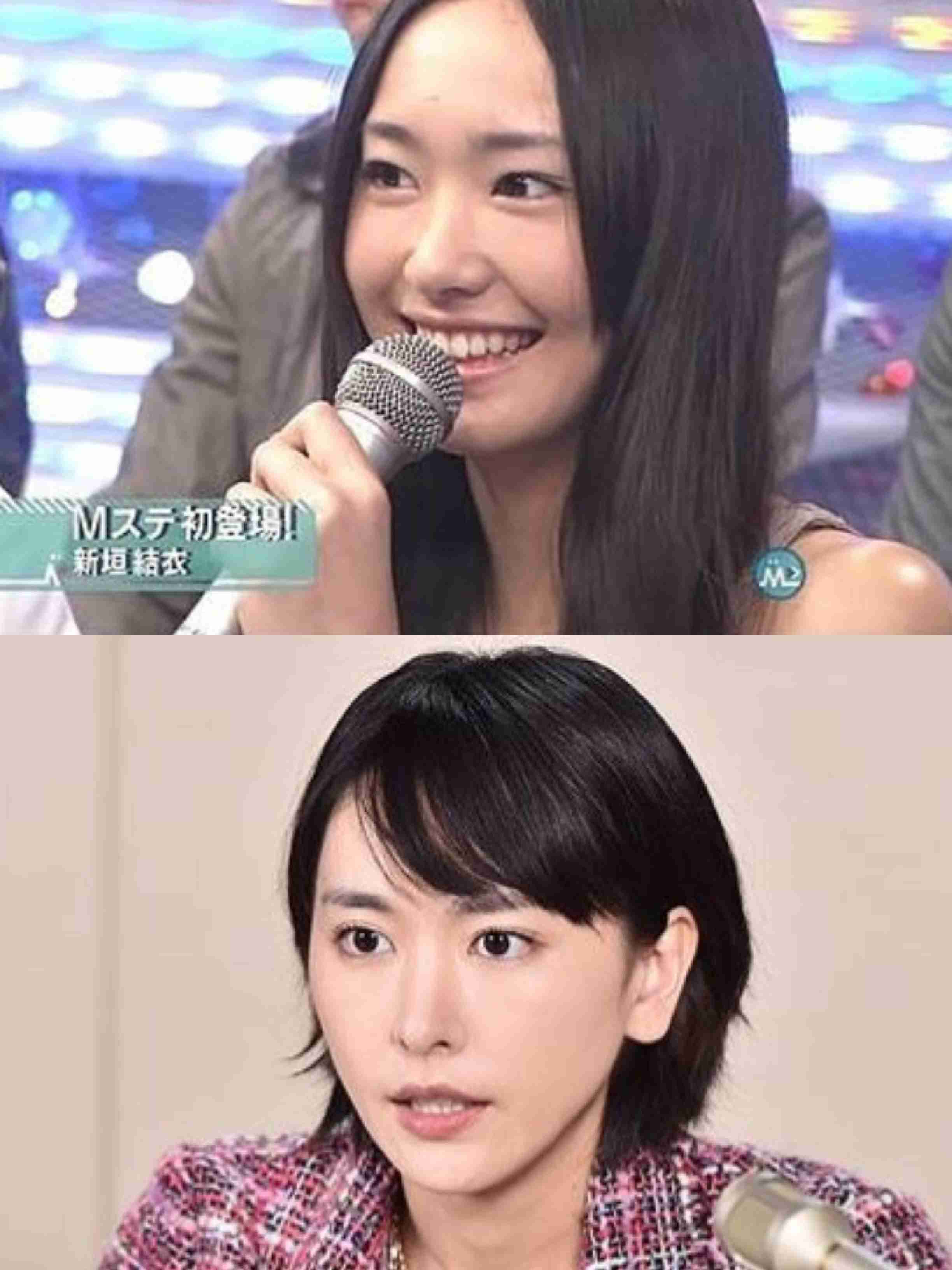 マジで整形やり過ぎてる！と思う芸能人は？