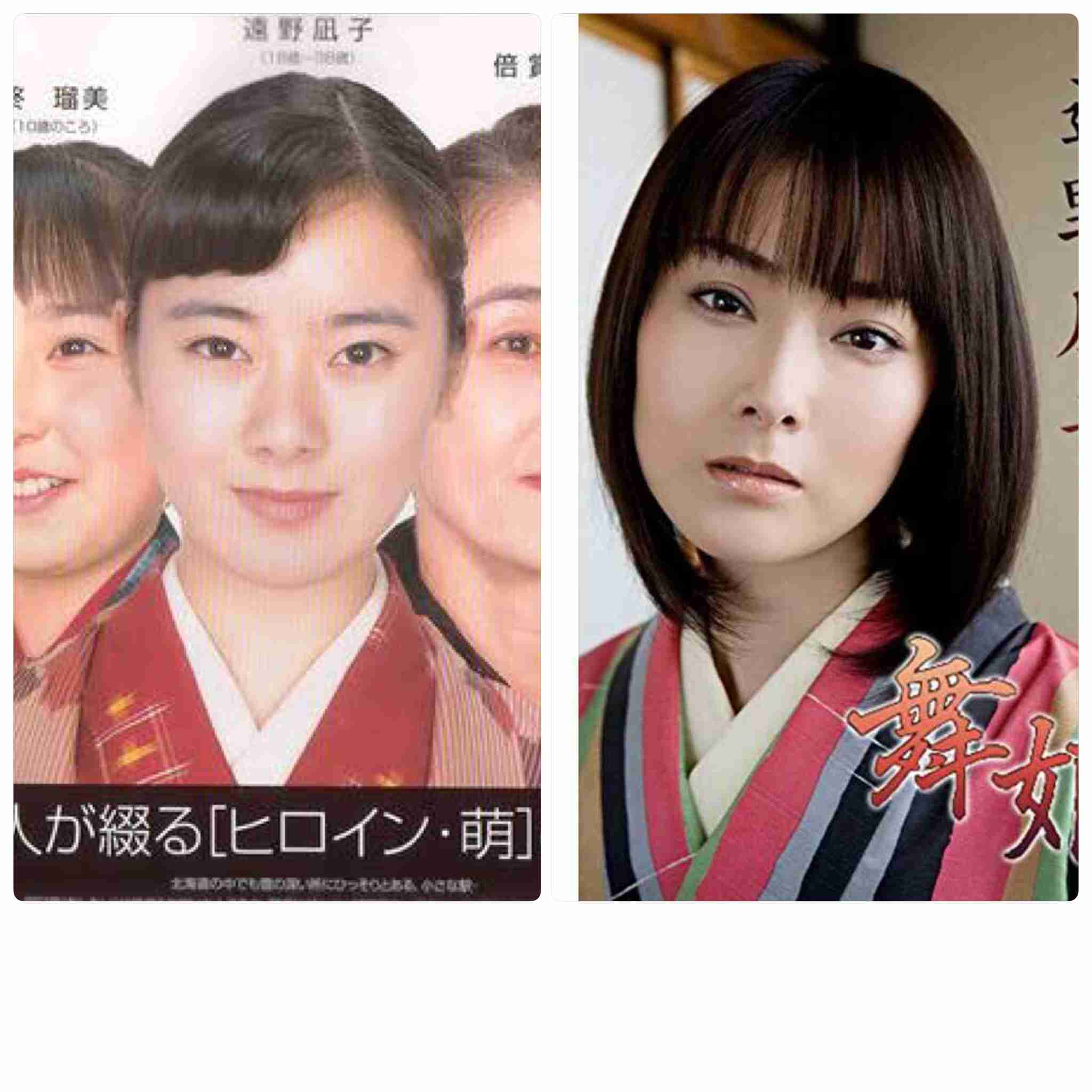 マジで整形やり過ぎてる！と思う芸能人は？