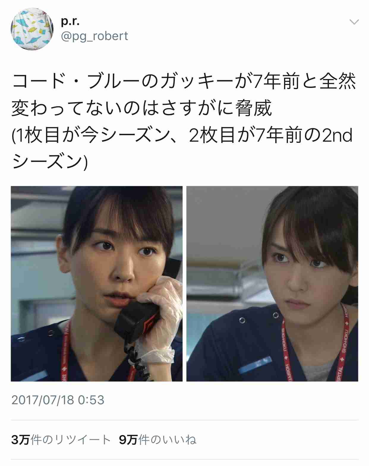 マジで整形やり過ぎてる！と思う芸能人は？