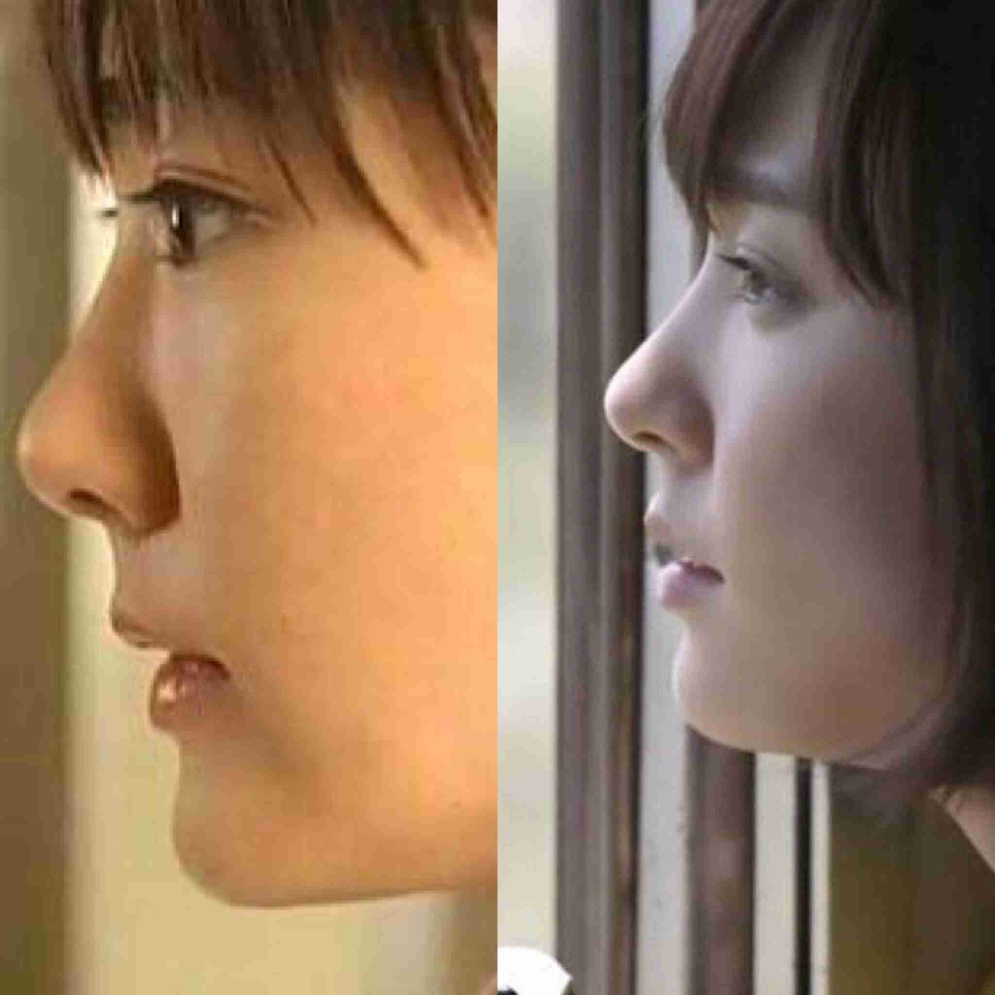 マジで整形やり過ぎてる！と思う芸能人は？