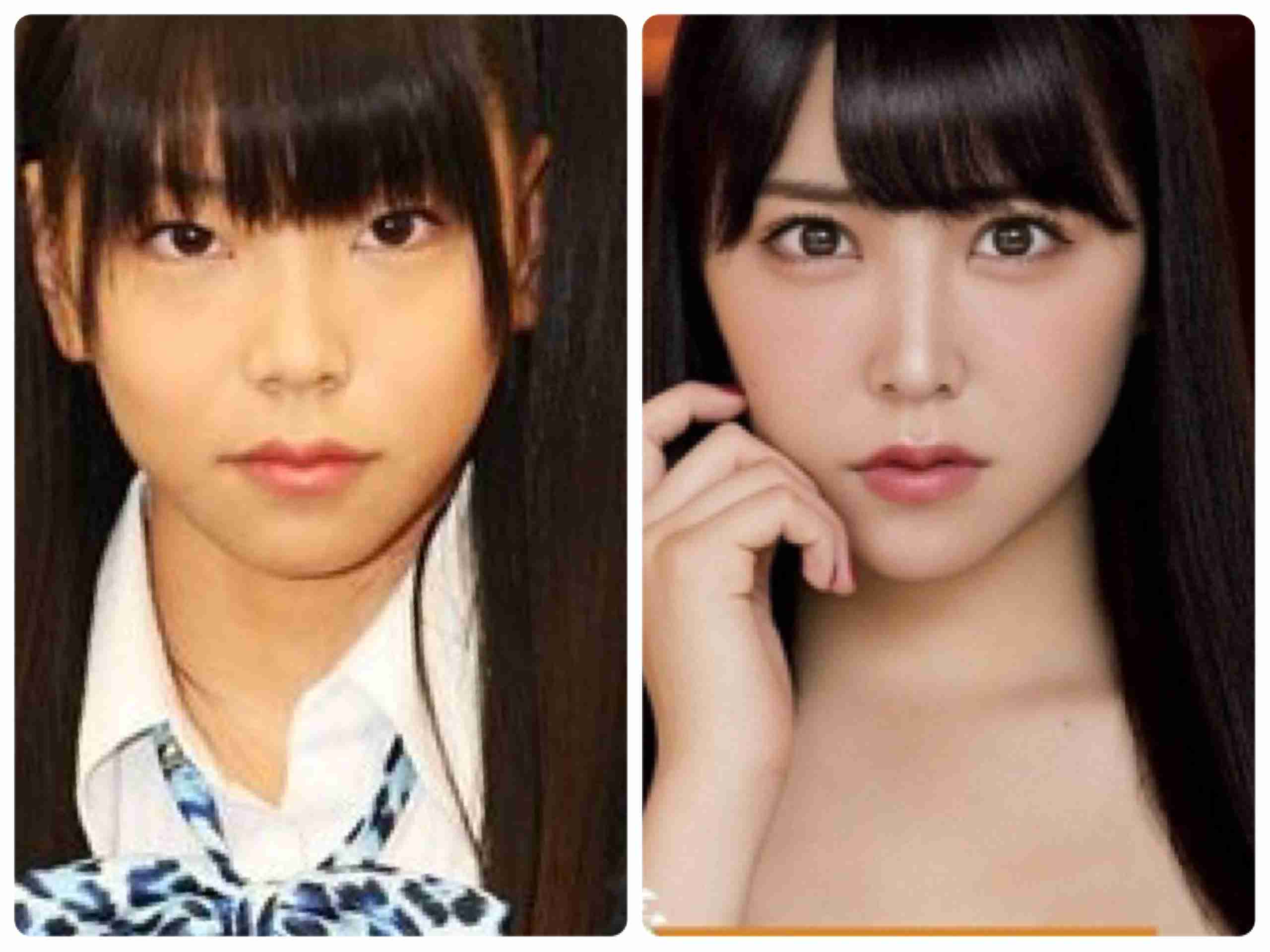 マジで整形やり過ぎてる!と思う芸能人は?