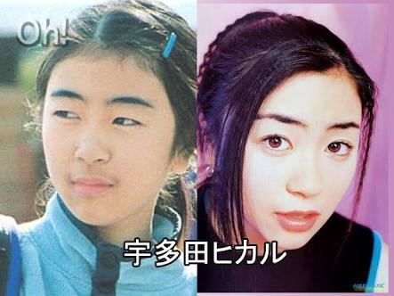 マジで整形やり過ぎてる!と思う芸能人は?