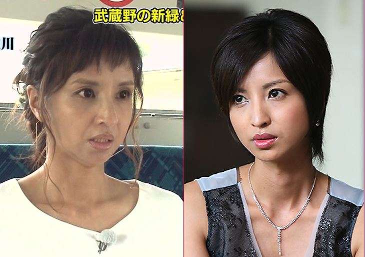 マジで整形やり過ぎてる！と思う芸能人は？