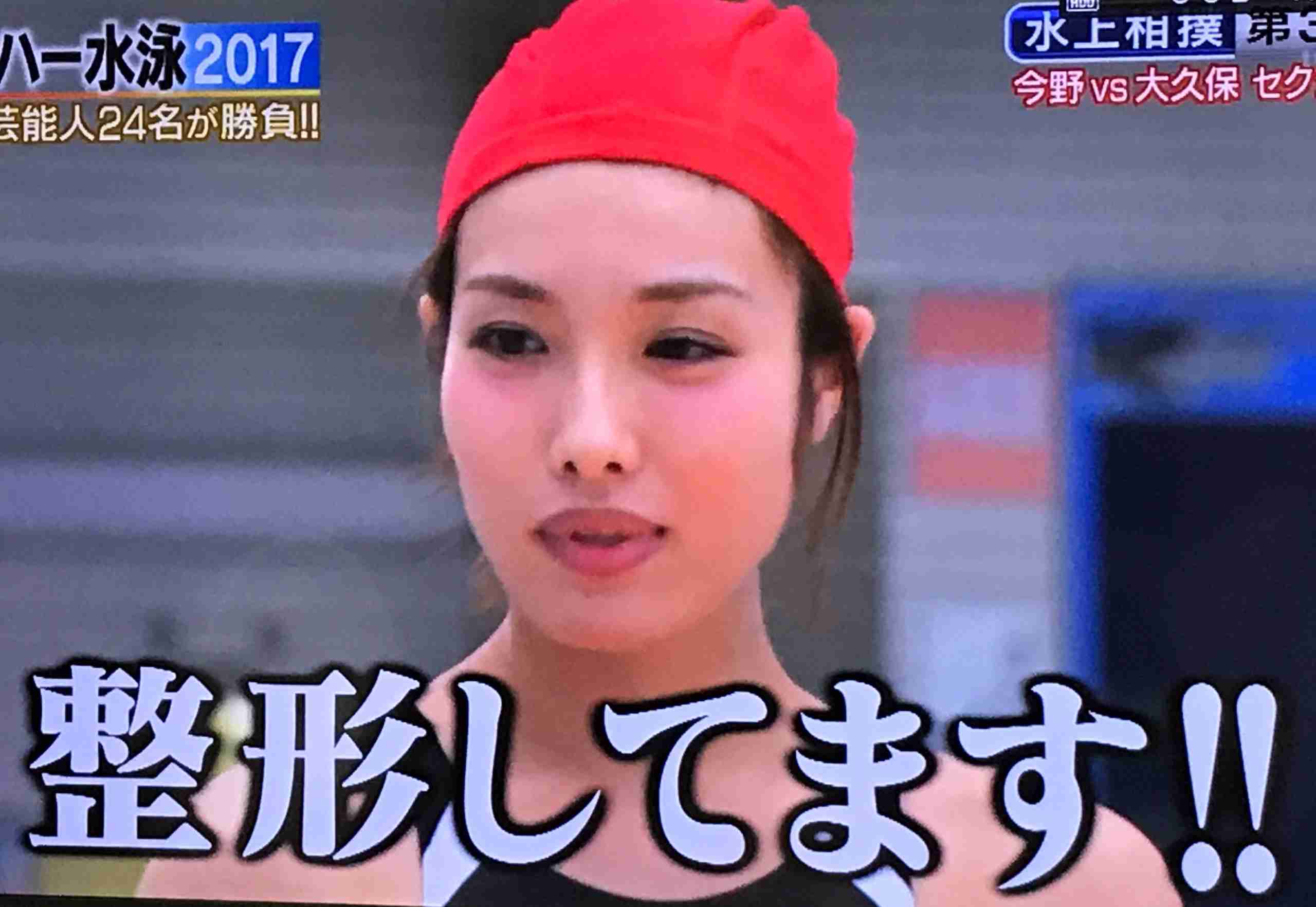 マジで整形やり過ぎてる！と思う芸能人は？