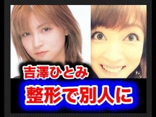 マジで整形やり過ぎてる!と思う芸能人は?