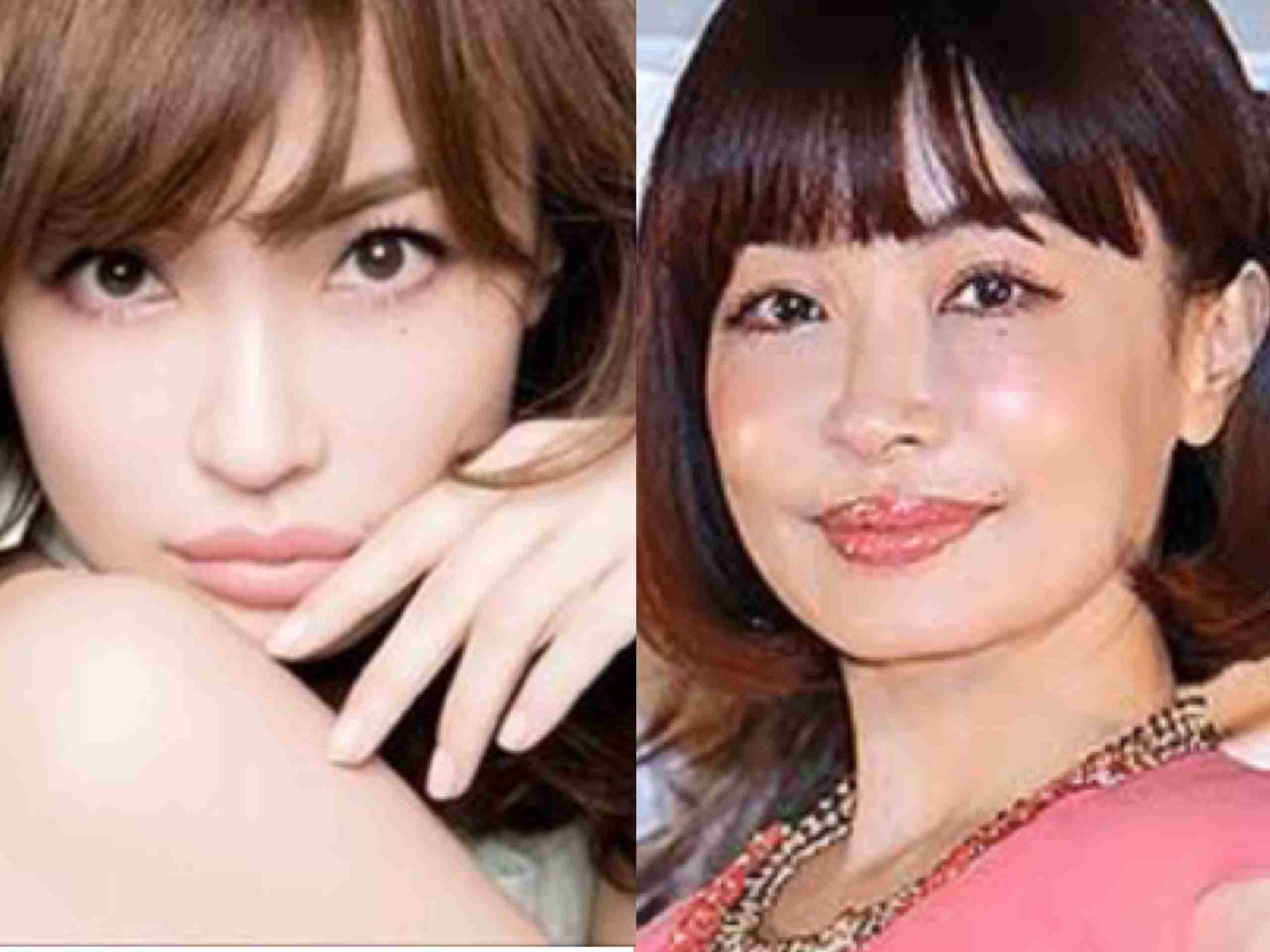 マジで整形やり過ぎてる!と思う芸能人は?