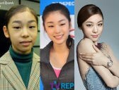 マジで整形やり過ぎてる!と思う芸能人は?