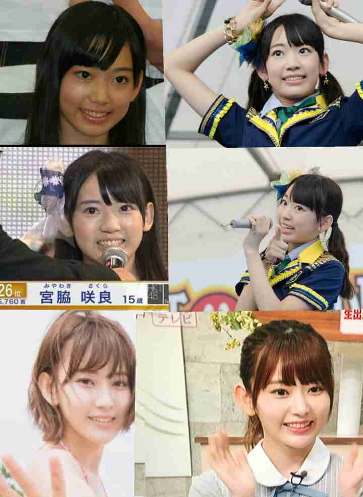 マジで整形やり過ぎてる!と思う芸能人は?