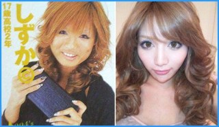 マジで整形やり過ぎてる!と思う芸能人は?