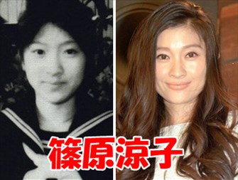 マジで整形やり過ぎてる!と思う芸能人は?