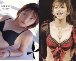 マジで整形やり過ぎてる!と思う芸能人は?