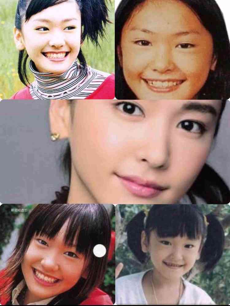 マジで整形やり過ぎてる！と思う芸能人は？
