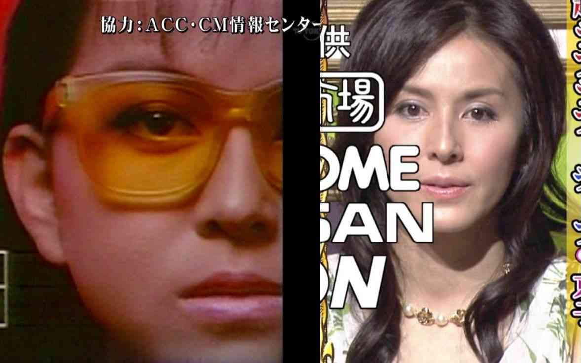 マジで整形やり過ぎてる！と思う芸能人は？