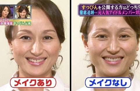 マジで整形やり過ぎてる！と思う芸能人は？