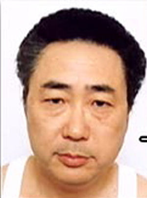 マジで整形やり過ぎてる!と思う芸能人は?