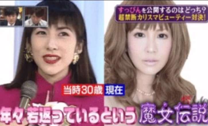 マジで整形やり過ぎてる！と思う芸能人は？