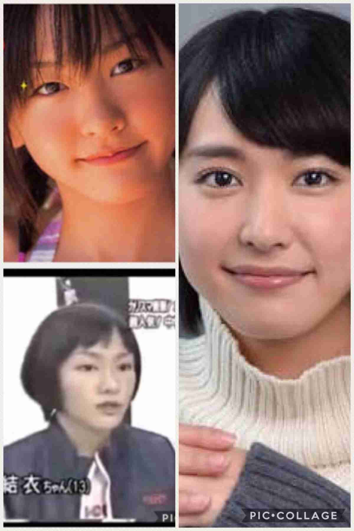 マジで整形やり過ぎてる！と思う芸能人は？