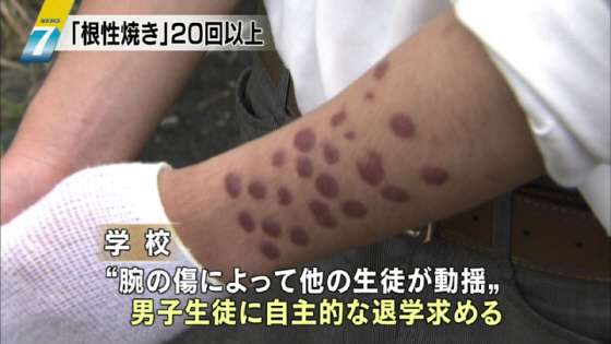 【実況・感想】第99回全国高校野球選手権大会　11日目