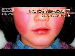 味方をフルーツの名前で呼び合って秘密の組織っぽい気分になろう