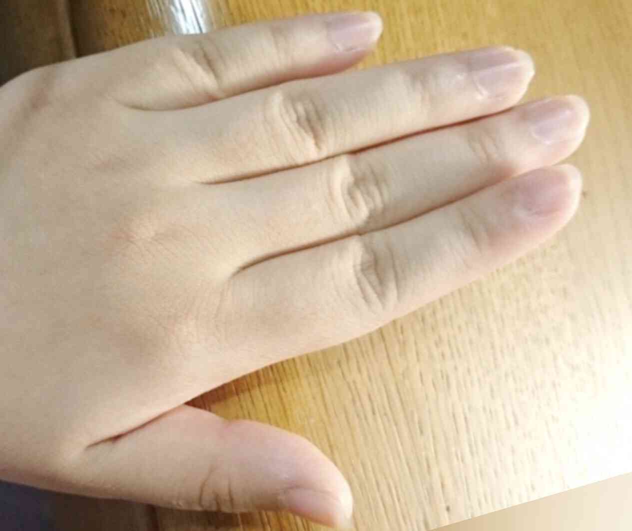 関節が太い人