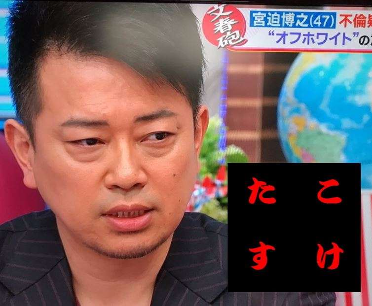 不倫疑惑の宮迫博之が出演「アフラック」CM動画が公式サイトから削除