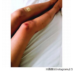 自己顕示欲をなくしたい