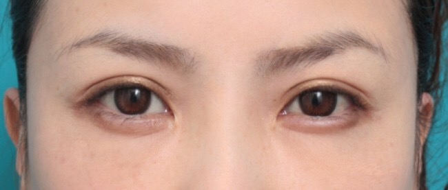奥二重のアイメイク