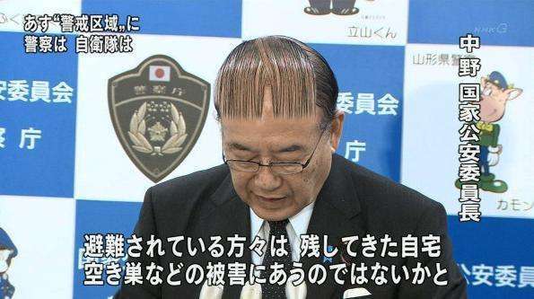 前髪が少ない人