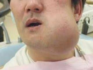 【タスケテ!】旦那が風呂に入らず歯磨きせず寝ます