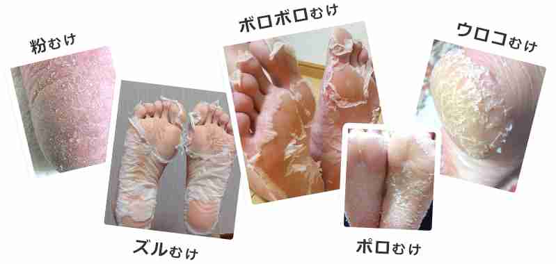 かかとがガサガサの人