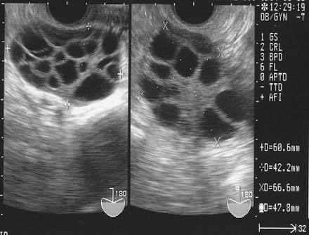 【リアルおそ松くん】3人の子どもが居る夫婦、六つ子が発覚し9人の子どもに!