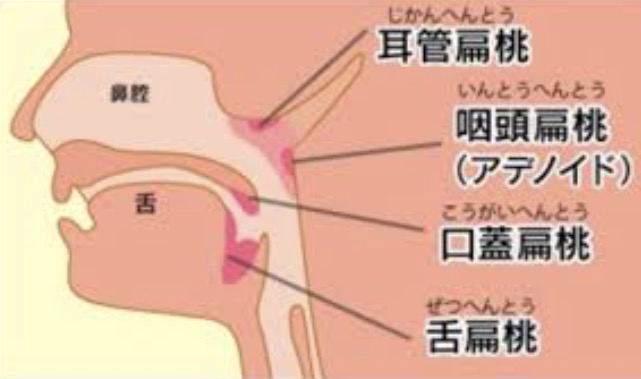 扁桃腺の弱い人！