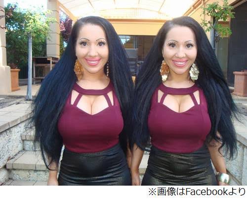 人気双子モデル・吉川ちえ&ちか、そろって整形手術再び「顎がはえたよん」