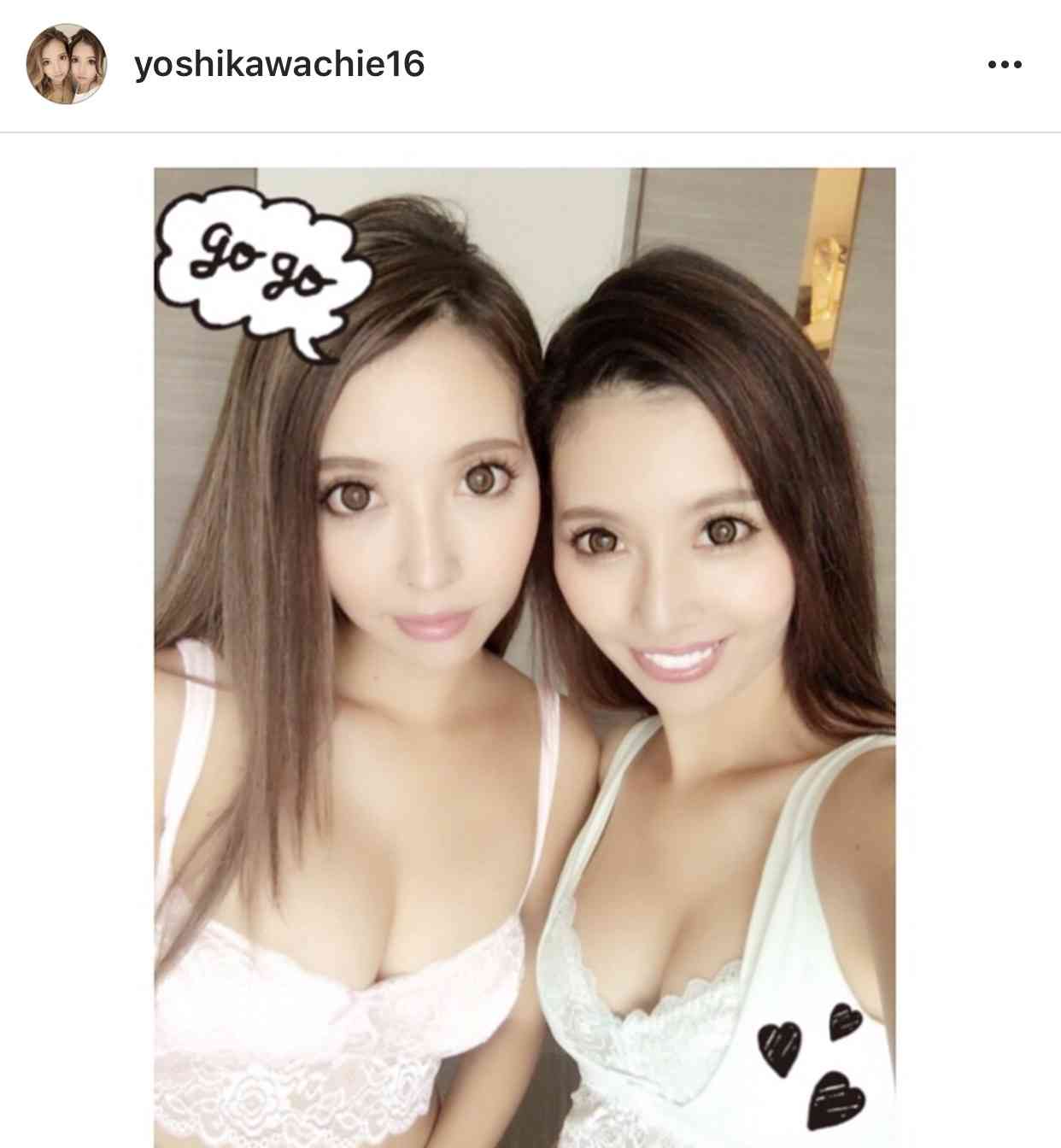 人気双子モデル・吉川ちえ&ちか、そろって整形手術再び「顎がはえたよん」