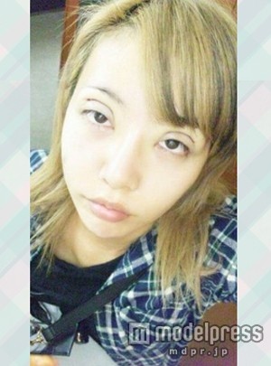 人気双子モデル・吉川ちえ&ちか、そろって整形手術再び「顎がはえたよん」