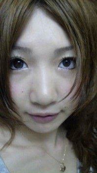 整形公表の「あいのり」桃、術後の経過を報告