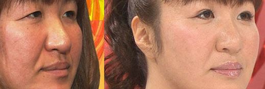 多部未華子「顔が違う」騒動の余波!? 櫻井翔の「首」にガッカリの声続出
