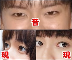 多部未華子「顔が違う」騒動の余波!? 櫻井翔の「首」にガッカリの声続出