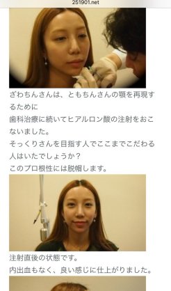 出雲大社で星条旗、ひめゆりの塔で「気持ちよくない」……“常識外れ”ざわちんの危険度