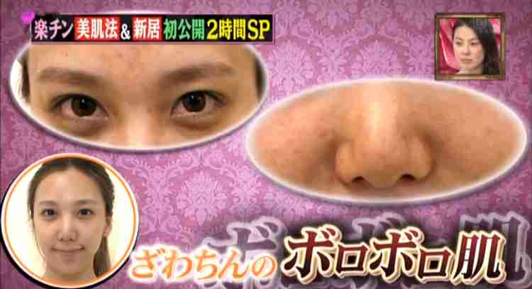 出雲大社で星条旗、ひめゆりの塔で「気持ちよくない」……“常識外れ”ざわちんの危険度