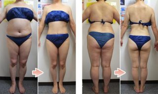 ダイエットのビフォーアフターがたくさん見たいです！