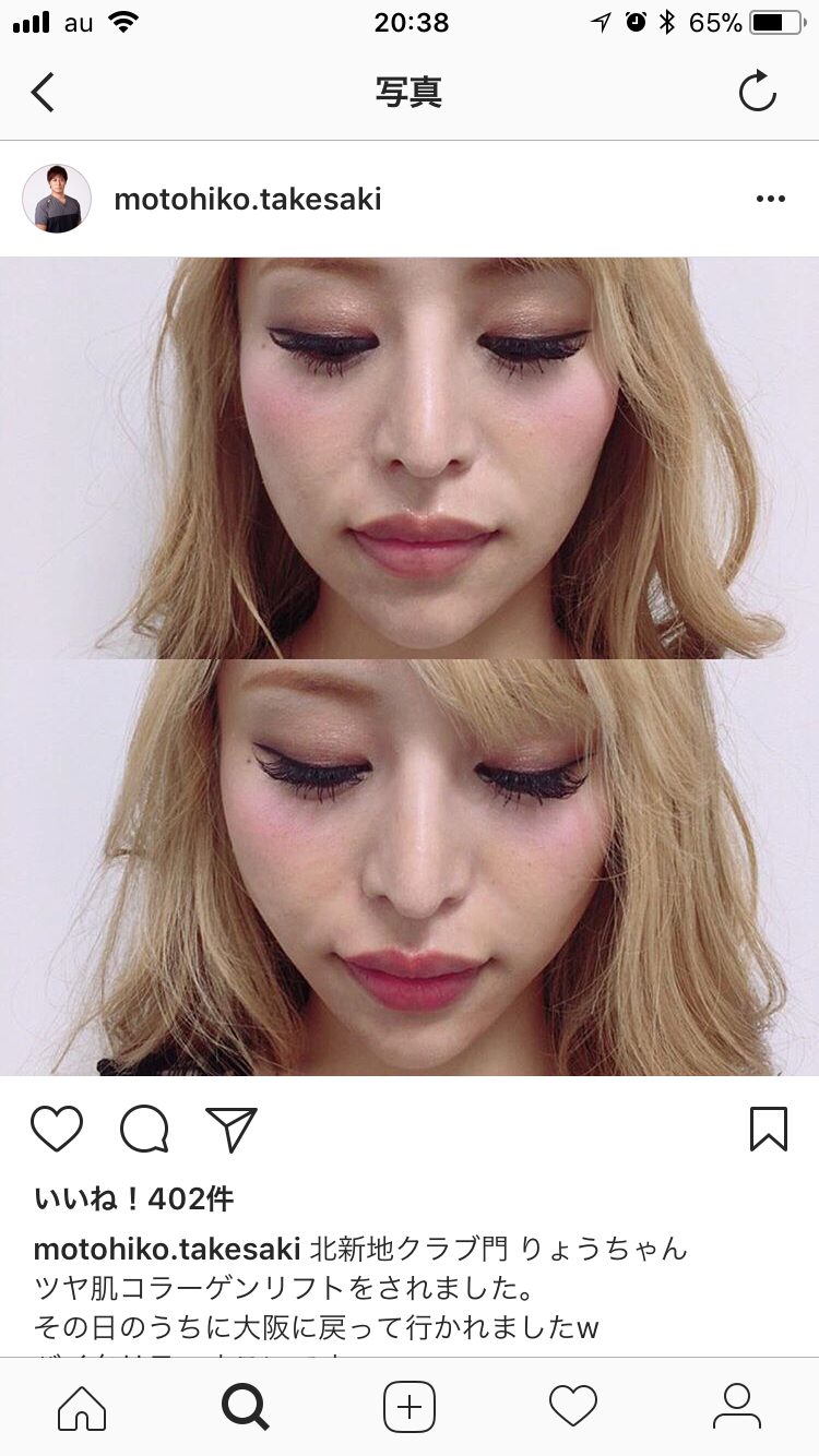 美容皮膚科に通っている方