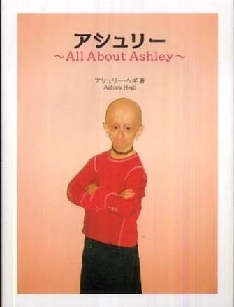 2歳で胸が膨らみ4歳で初潮、5歳で更年期障害と直面する女児（豪）