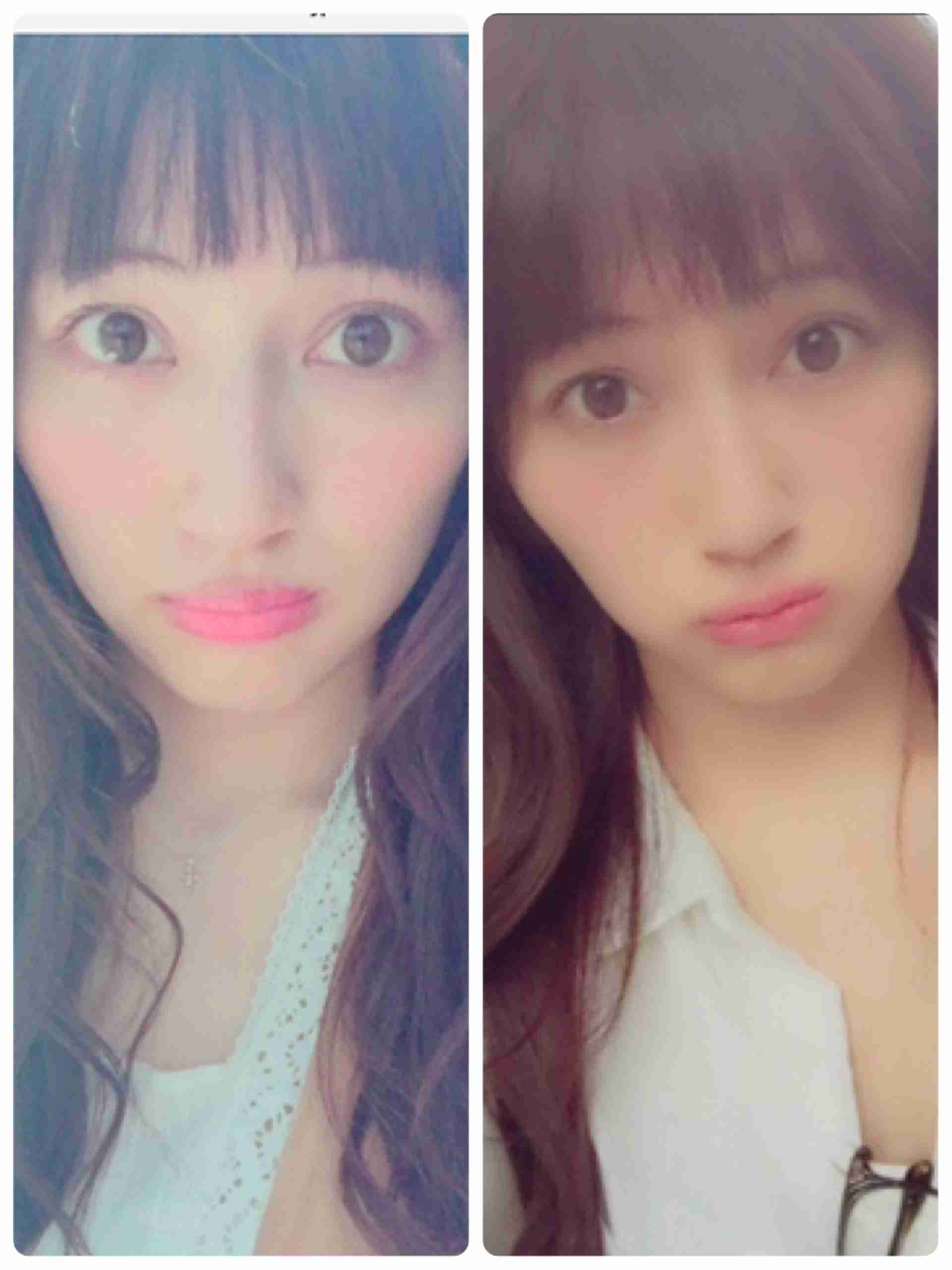 NEWS小山慶一郎の彼女にキスマーク疑惑でファン大騒ぎ！『Mステ』では手越祐也の首元にも…