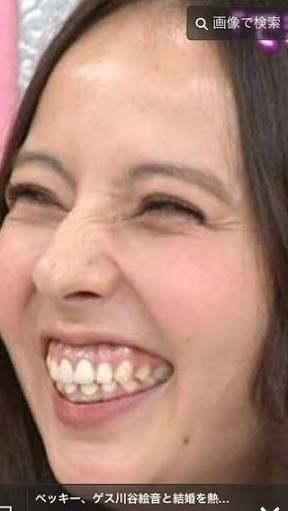 コミュ障の治し方